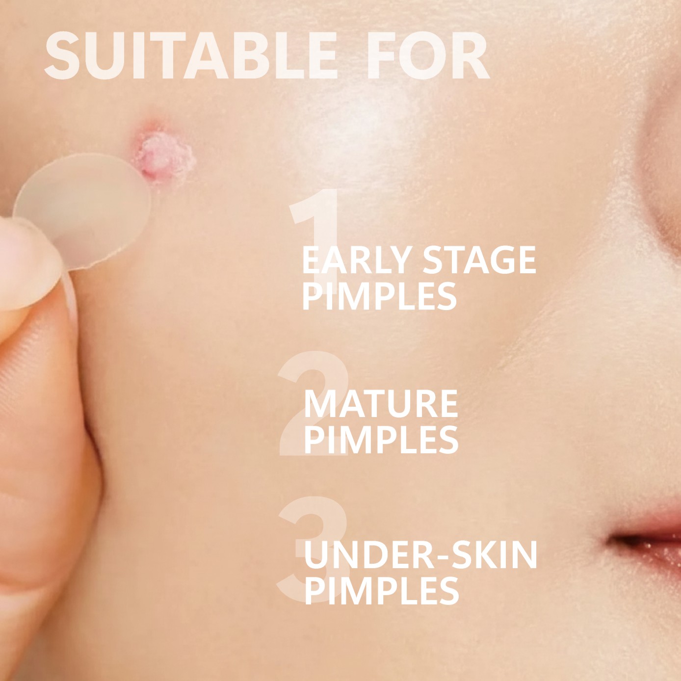 Micro Needle Pimple Patch (24  - đánh giá và giá Face Moisturizer