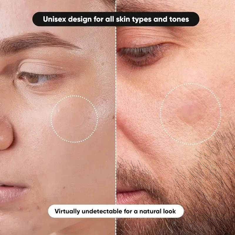 360 pieces/box acne patches -  - đánh giá và giá Face Oil