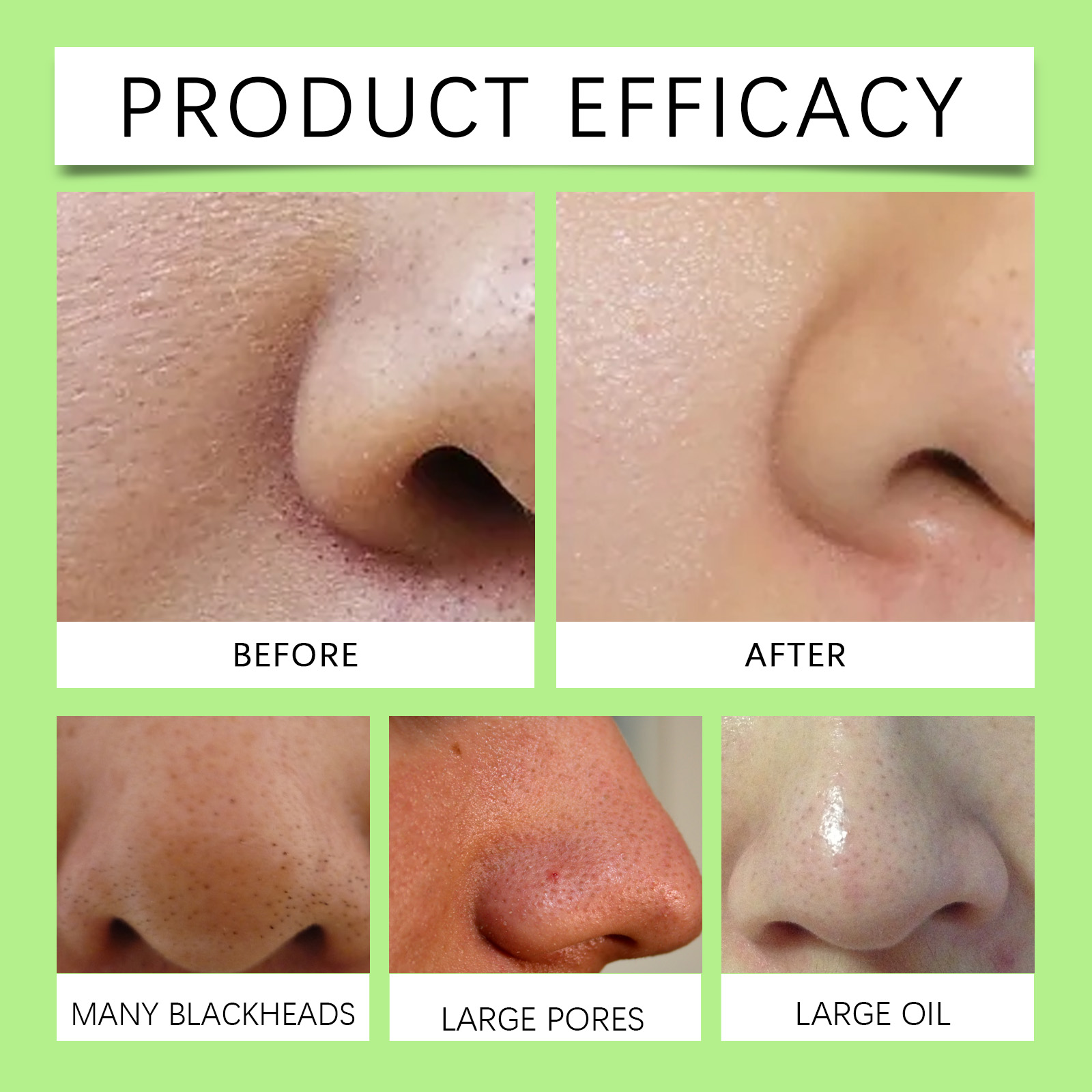 Bamboo Charcoal Nose Strips fo - đánh giá và giá Cleanser Face